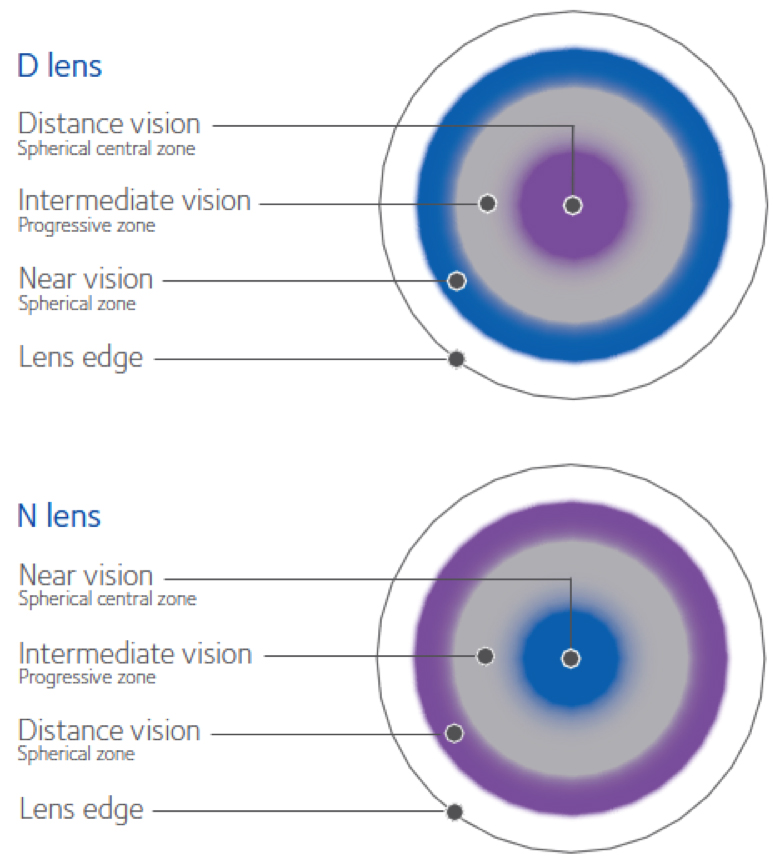Bifocal and Multifocal Contact Lenses - D lens / N lens