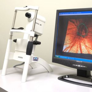 glaucoma-testing